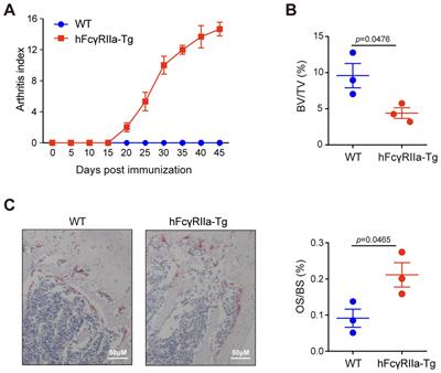 hFcγRIIa: a double-edged sword in osteoclastogenesis and bone balance in transgenic mice